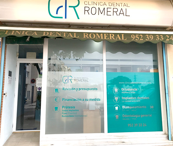 Clinica Dental Romeral en teatinos malaga